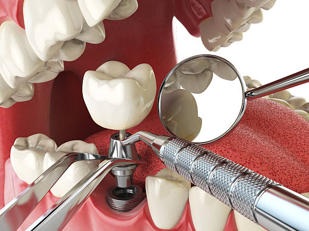 Best Emergency Gum Treatment in Jacksonville, AL